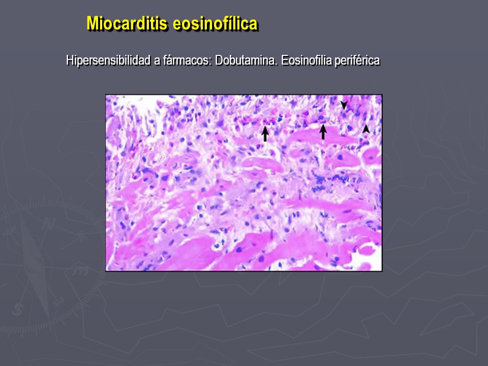 Curso Trianual De Cardiologia Ppt Descargar
