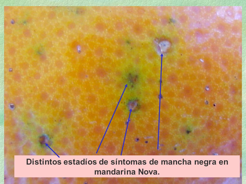 Distintos estadíos de síntomas de mancha negra en mandarina Nova.