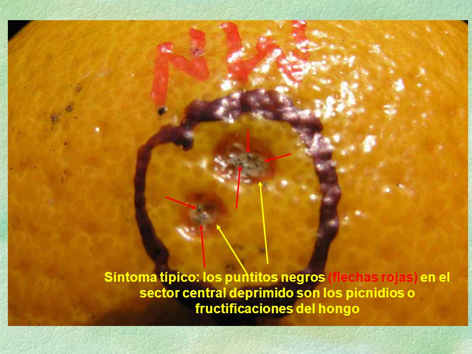 Síntoma típico: los puntitos negros (flechas rojas) en el sector central deprimido son los picnidios o fructificaciones del hongo