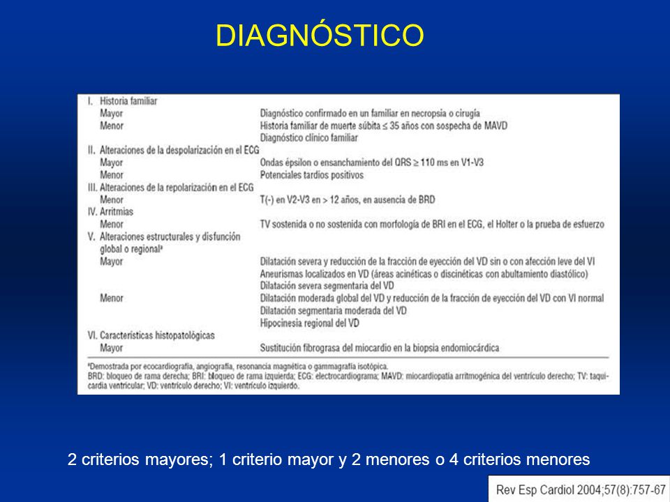 DIAGNÓSTICO 2 criterios mayores; 1 criterio mayor y 2 menores o 4 criterios menores