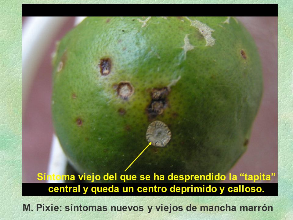 Síntoma viejo del que se ha desprendido la tapita central y queda un centro deprimido y calloso.
