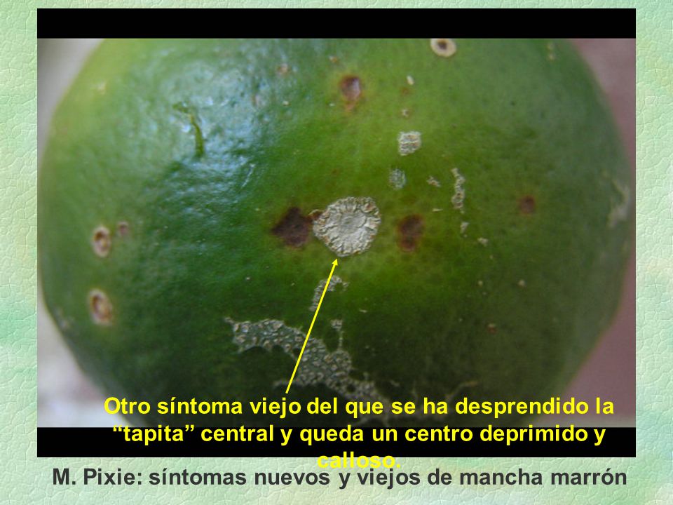 Otro síntoma viejo del que se ha desprendido la tapita central y queda un centro deprimido y calloso.