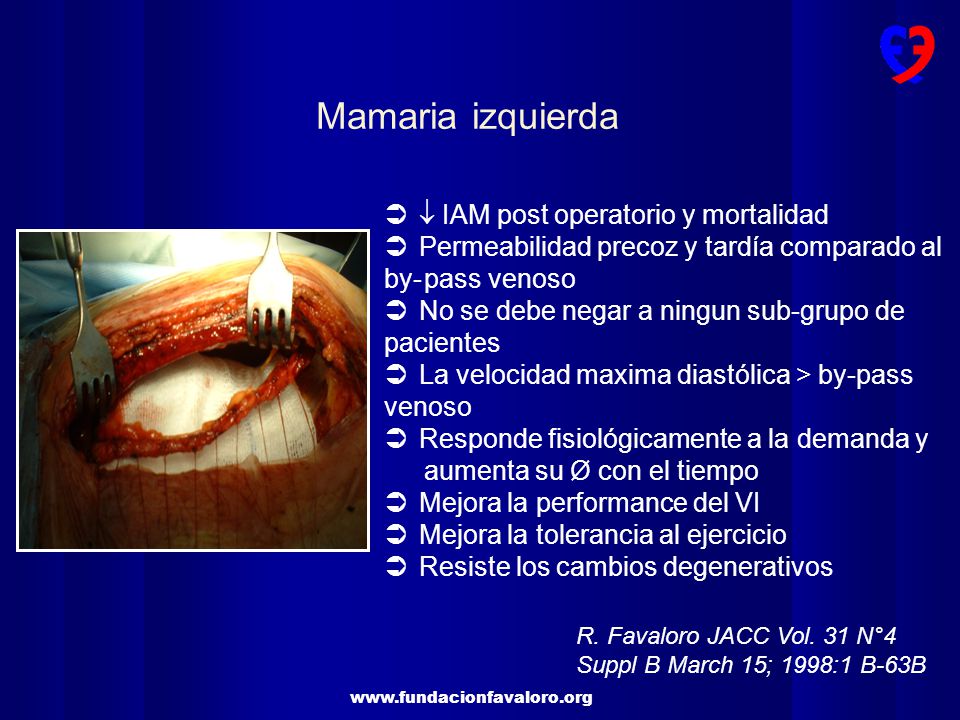 Mamaria izquierda  IAM post operatorio y mortalidad
