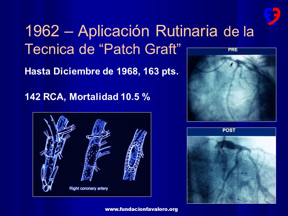 1962 – Aplicación Rutinaria de la Tecnica de Patch Graft