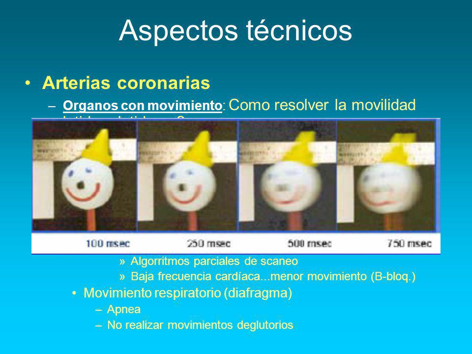 Aspectos técnicos Menor Resolución temporal : Arterias coronarias
