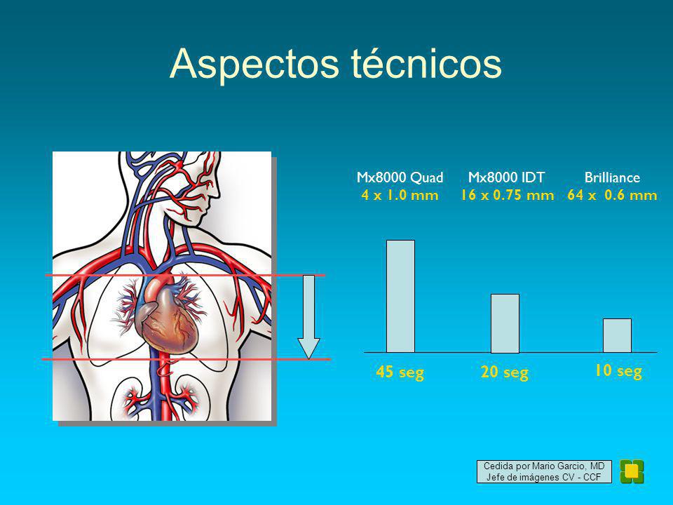 Aspectos técnicos 45 seg 20 seg 10 seg Mx8000 Quad 4 x 1.0 mm