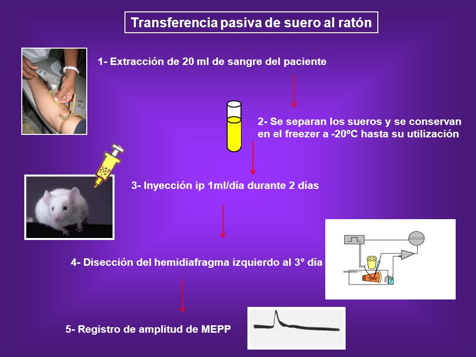 Transferencia pasiva de suero al ratón 5- Registro de amplitud de MEPP