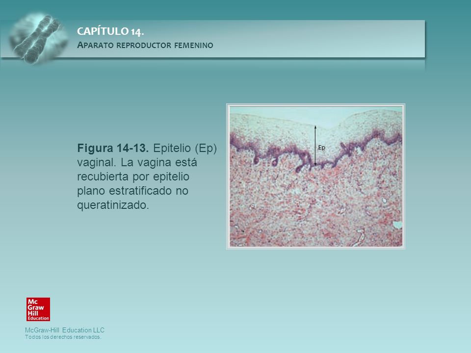 Figura Epitelio (Ep) vaginal