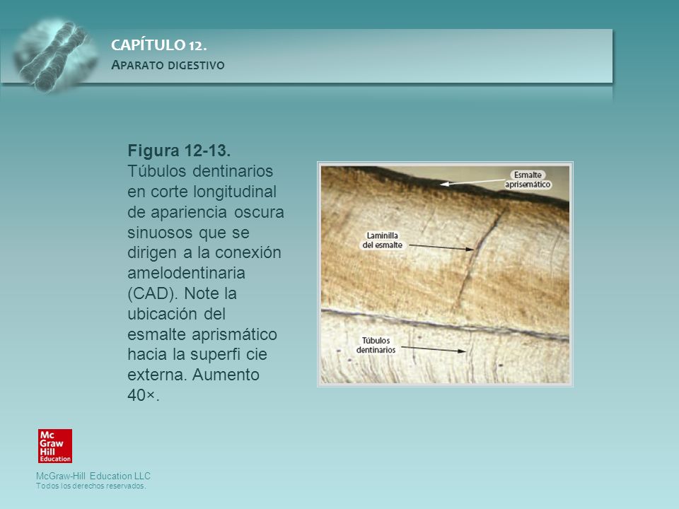 Figura Túbulos dentinarios en corte longitudinal de apariencia oscura sinuosos que se dirigen a la conexión amelodentinaria