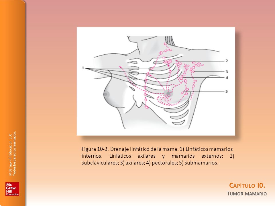 Figura Drenaje linfático de la mama. 1) Linfáticos mamarios