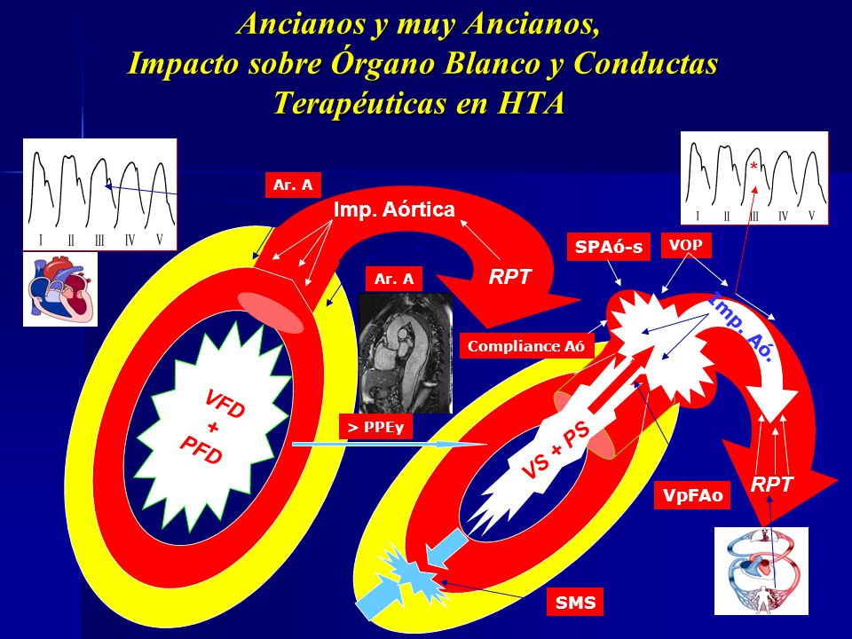 Ancianos y muy Ancianos, Impacto sobre Órgano Blanco y Conductas Terapéuticas en HTA