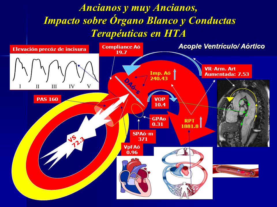 Ancianos y muy Ancianos, Impacto sobre Órgano Blanco y Conductas Terapéuticas en HTA