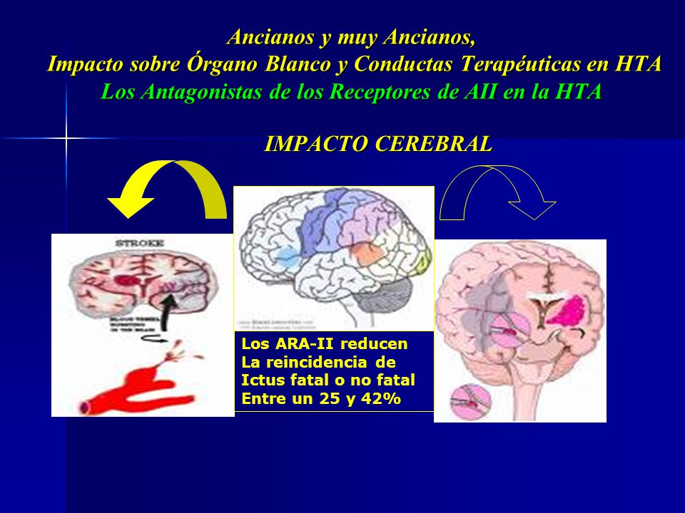 Ancianos y muy Ancianos, Impacto sobre Órgano Blanco y Conductas Terapéuticas en HTA Los Antagonistas de los Receptores de AII en la HTA