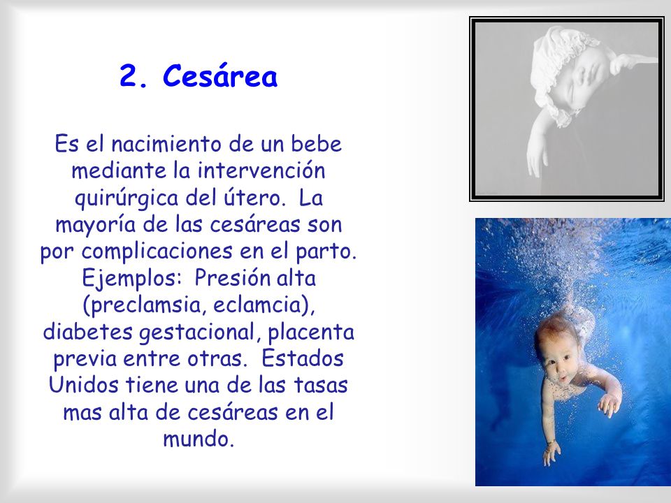 2. Cesárea Es el nacimiento de un bebe mediante la intervención quirúrgica del útero.
