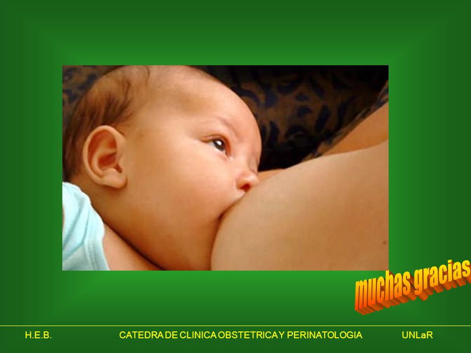 muchas gracias H.E.B. CATEDRA DE CLINICA OBSTETRICA Y PERINATOLOGIA UNLaR