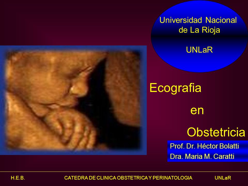Ecografia en Obstetricia Universidad Nacional de La Rioja UNLaR