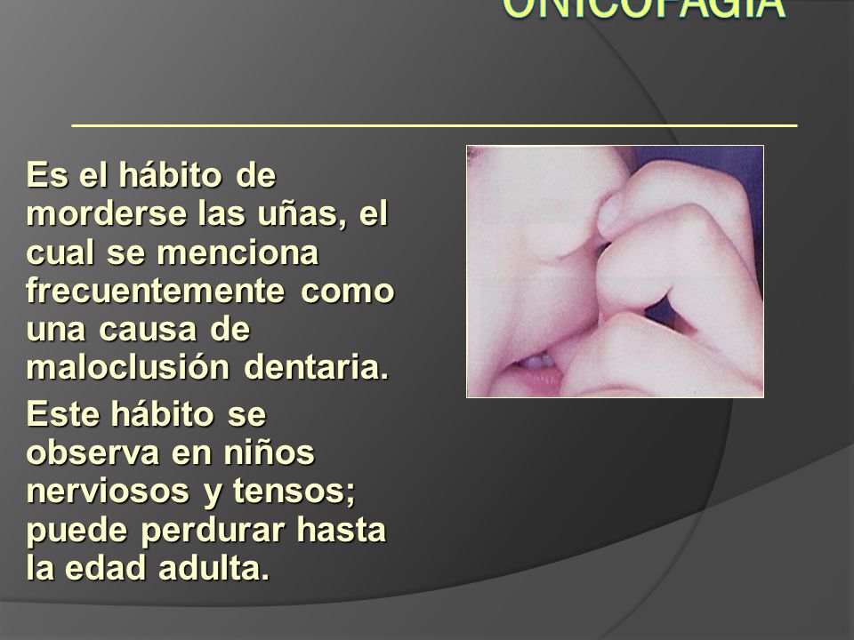 Onicofagia Hábitos. Es el hábito de morderse las uñas, el cual se menciona frecuentemente como una causa de maloclusión dentaria.