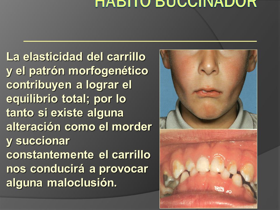 Hábito Buccinador Hábitos.