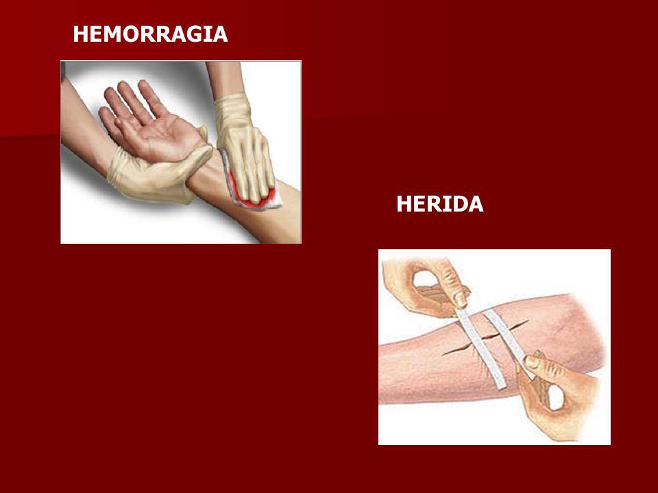 HEMORRAGIA HERIDA