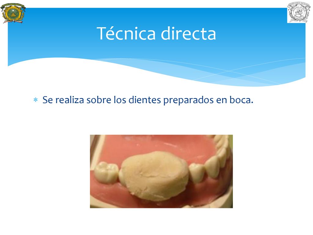 Técnica directa Se realiza sobre los dientes preparados en boca.