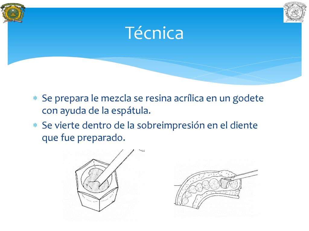 Técnica Se prepara le mezcla se resina acrílica en un godete con ayuda de la espátula.