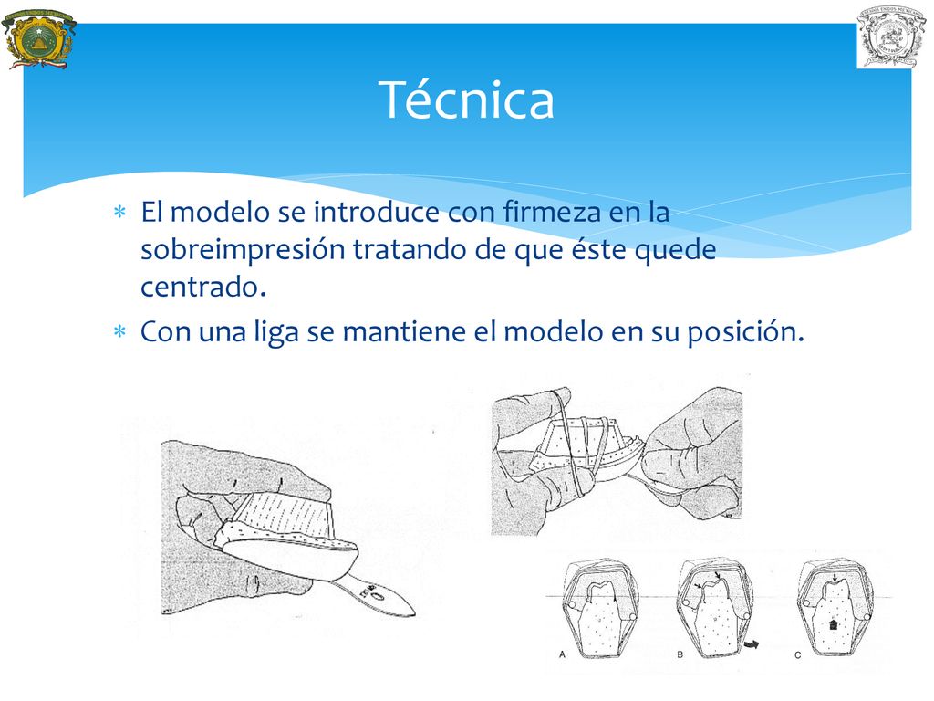 Técnica El modelo se introduce con firmeza en la sobreimpresión tratando de que éste quede centrado.