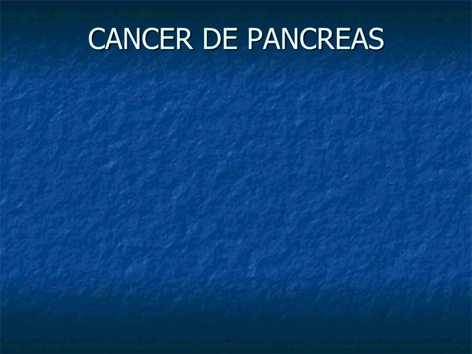 CANCER DE PANCREAS