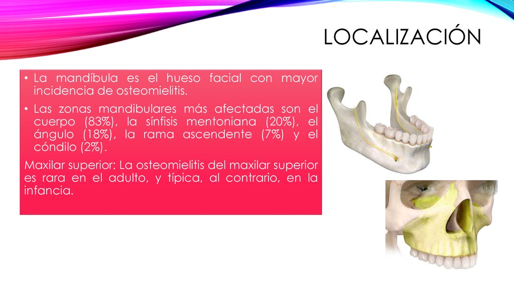 localización La mandíbula es el hueso facial con mayor incidencia de osteomielitis.
