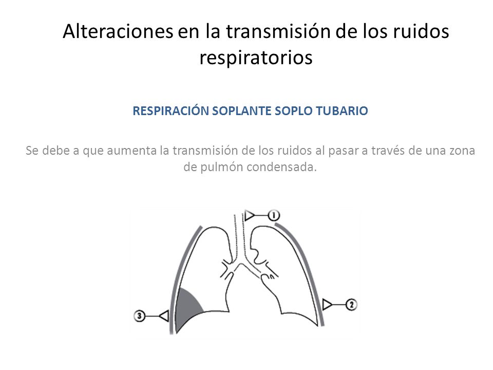 Alteraciones en la transmisión de los ruidos respiratorios