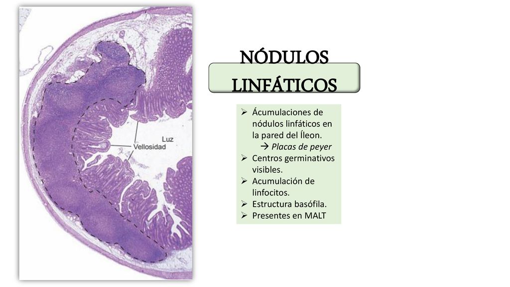 NÓDULOS LINFÁTICOS Ácumulaciones de nódulos linfáticos en la pared del Íleon.  Placas de peyer. Centros germinativos visibles.