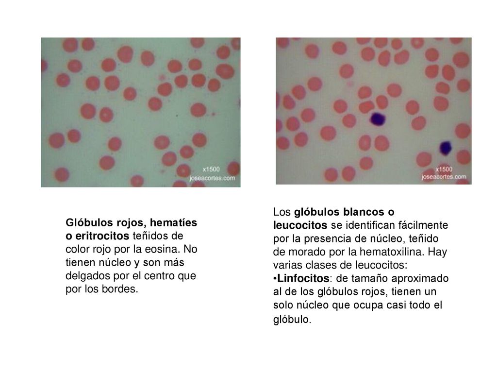 Los glóbulos blancos o leucocitos se identifican fácilmente por la presencia de núcleo, teñido de morado por la hematoxilina. Hay varias clases de leucocitos:
