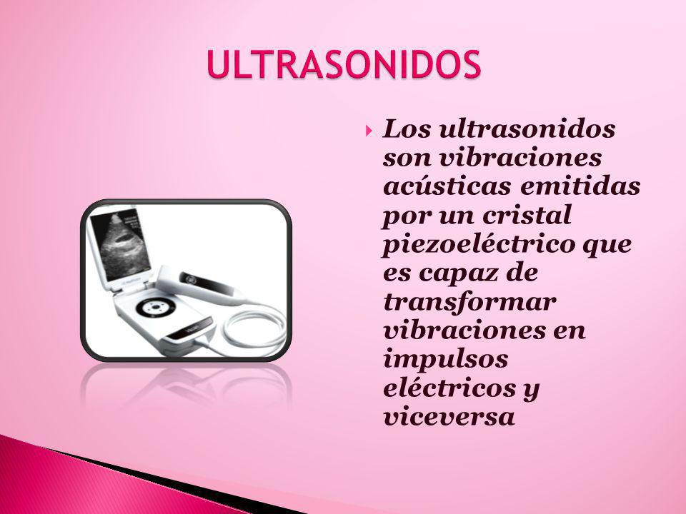 ULTRASONIDOS