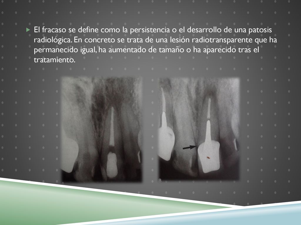 El fracaso se define como la persistencia o el desarrollo de una patosis radiológica.