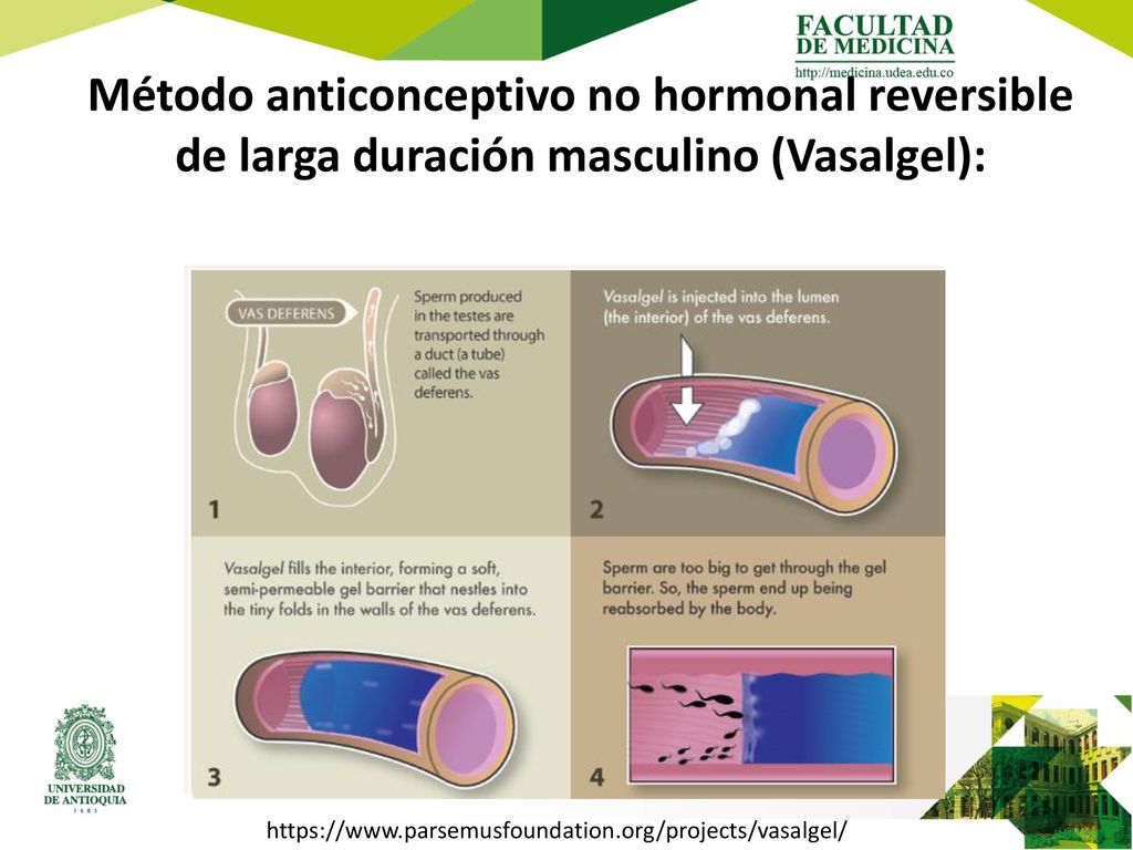 Método anticonceptivo no hormonal reversible de larga duración masculino (Vasalgel):
