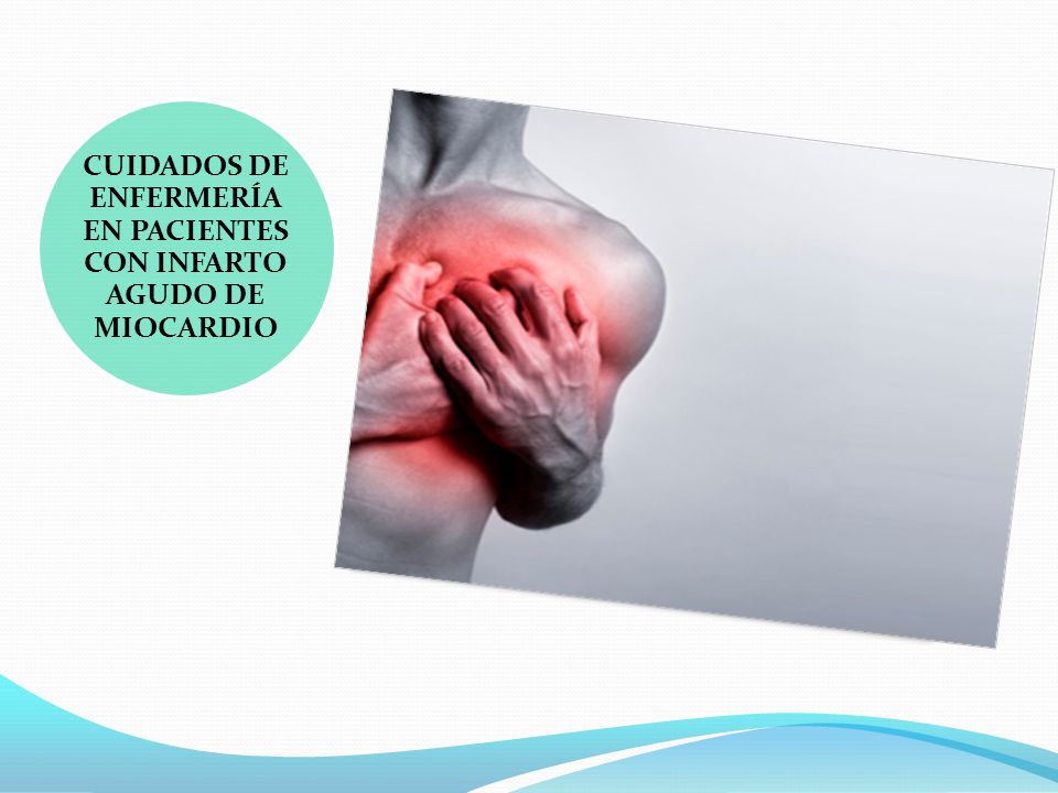 CUIDADOS DE ENFERMERÍA EN PACIENTES CON INFARTO AGUDO DE MIOCARDIO