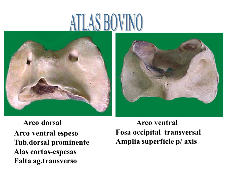 ATLAS BOVINO Arco dorsal Arco ventral Fosa occipital transversal