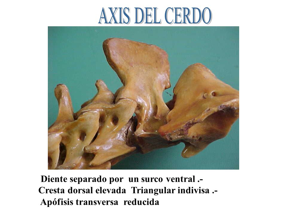 AXIS DEL CERDO Diente separado por un surco ventral .-