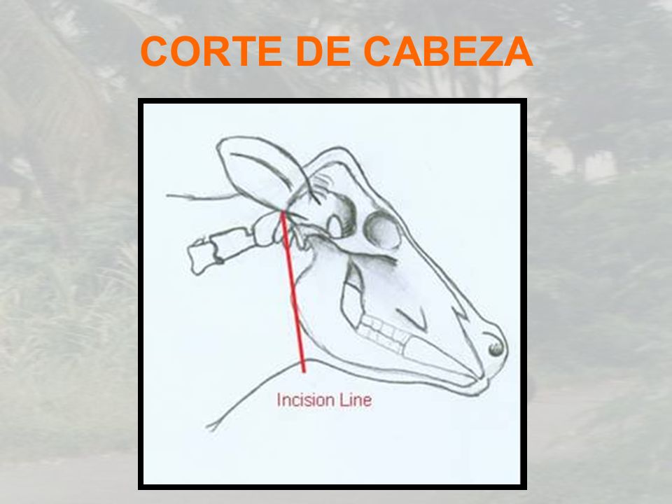 CORTE DE CABEZA