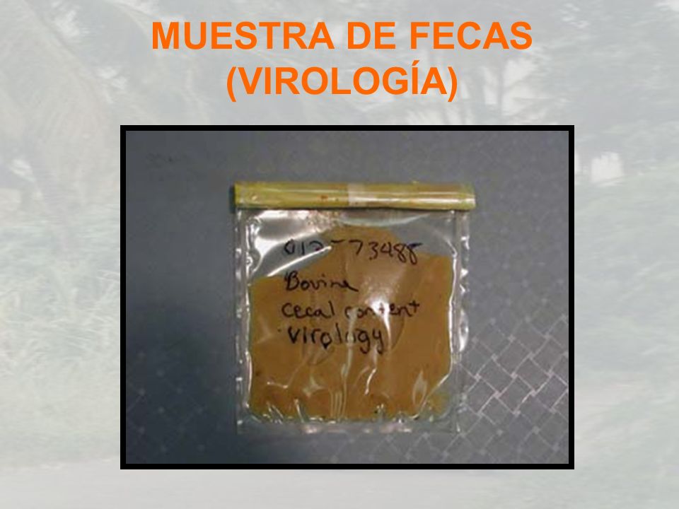 MUESTRA DE FECAS (VIROLOGÍA)