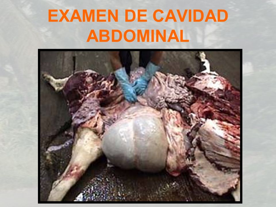 EXAMEN DE CAVIDAD ABDOMINAL