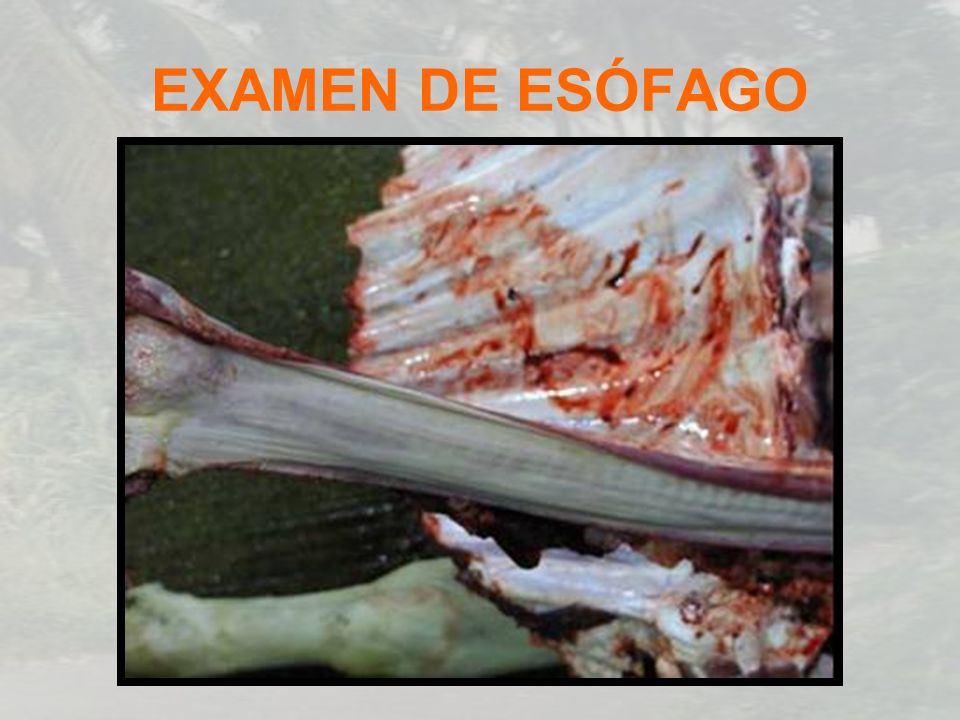 EXAMEN DE ESÓFAGO
