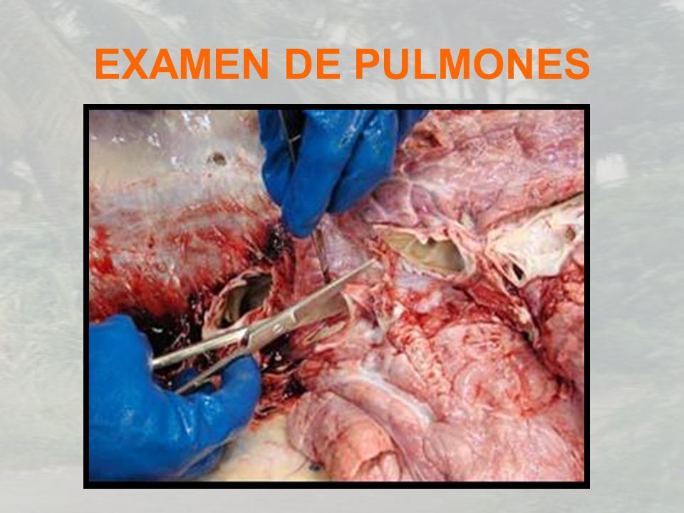 EXAMEN DE PULMONES