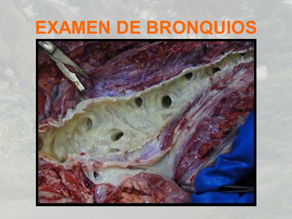 EXAMEN DE BRONQUIOS