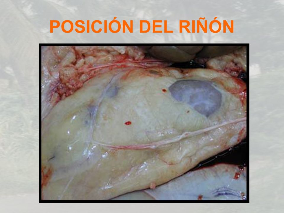 POSICIÓN DEL RIÑÓN