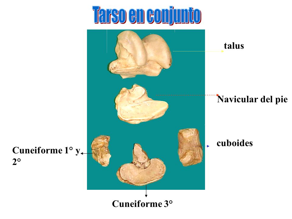 Tarso en conjunto talus Navicular del pie cuboides Cuneiforme 1° y 2°
