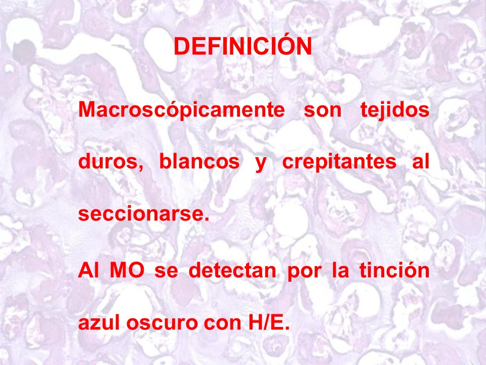 DEFINICIÓN Macroscópicamente son tejidos duros, blancos y crepitantes al seccionarse.