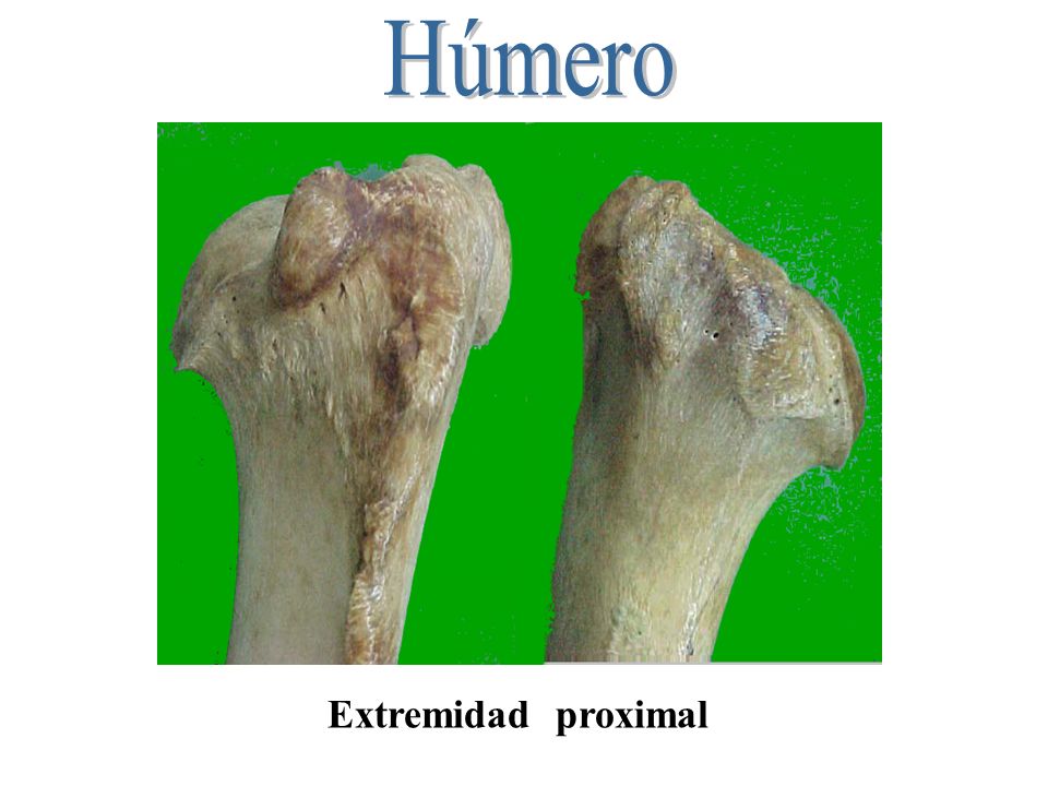Húmero Extremidad proximal