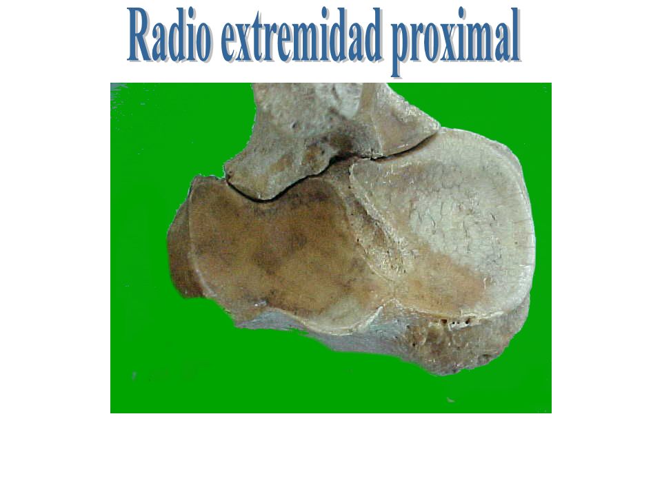 Radio extremidad proximal