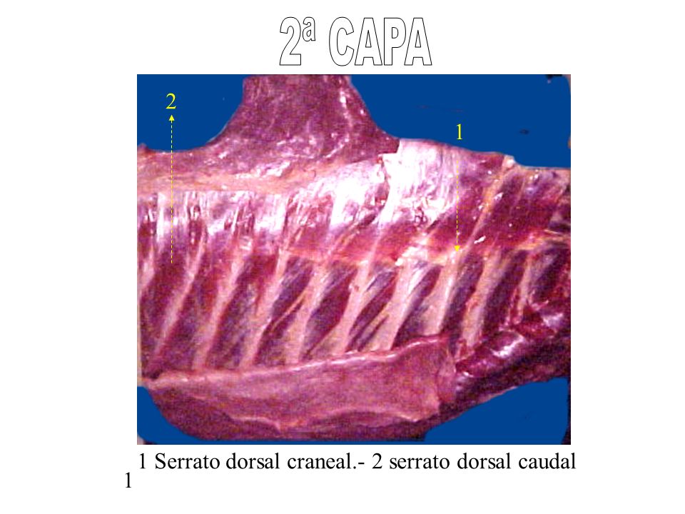 2ª CAPA Serrato dorsal craneal.- 2 serrato dorsal caudal 1