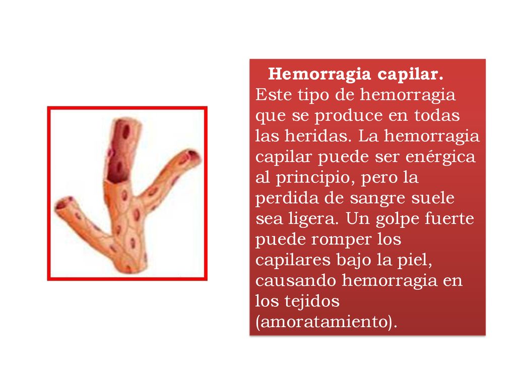 Hemorragia capilar. Este tipo de hemorragia que se produce en todas las heridas.